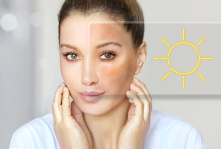 collagen-sun-hifu-bulgaria
