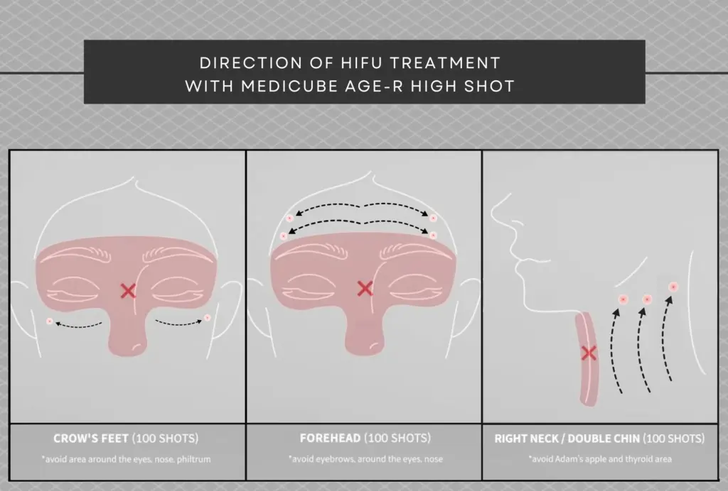 An instructional infographic titled "DIRECTION OF HIFU TREATMENT WITH MEDICUBE AGE-R HIGH SHOT". The image is divided into three sections: CROW'S FEET (100 SHOTS): Shows arrows moving outward from under the eyes towards the temples, with a warning to avoid the eyes, nose, and philtrum. FOREHEAD (100 SHOTS): Shows horizontal arrows moving from the center of the forehead towards the hairline, with a warning to avoid eyebrows, eyes, and the nose. RIGHT NECK / DOUBLE CHIN (100 SHOTS): Shows upward arrows moving from the base of the neck towards the jawline, with a strict warning to avoid the Adam's apple and thyroid area. Red 'X' marks clearly indicate prohibited treatment zones in each diagram for user safety.